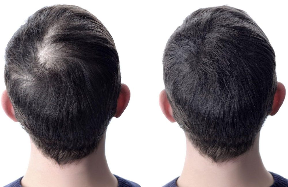 Hair products that can help mask your crown thinning