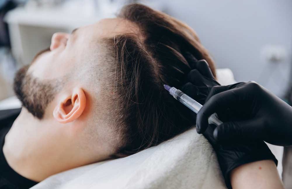 PDGF Hair Restoration